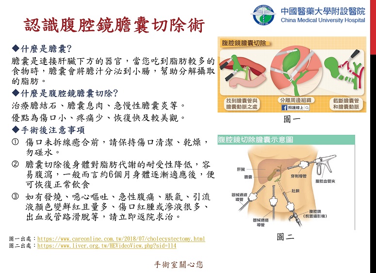 認識腹腔鏡膽囊切除術 衛教海報 中國醫藥大學附設醫院