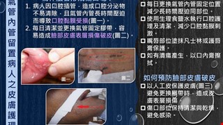 氣管內管留置病人之皮膚護理