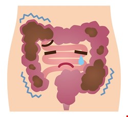 腸胃道鋇劑攝影檢查說明