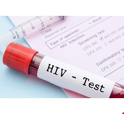 AIDS 愛滋病Q&A