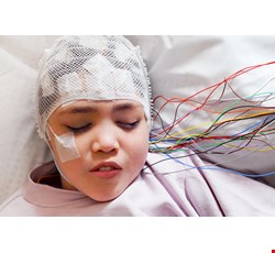 Seizures and Epilepsy 痙攣及癲癇