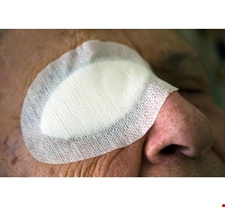 Precautions for Home Care After Eye Surgery 眼睛手術後居家護理注意事項