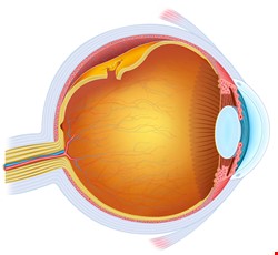 What is the cause of Retinal Detachment? 為什麼會視網膜剝離？