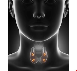 Parathyroidectomy 認識副甲狀腺切除術