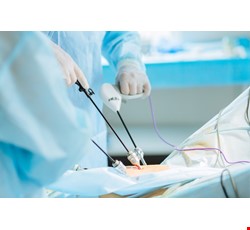 The matters about the Laparoscopy caring 腹腔鏡手術照護須知
