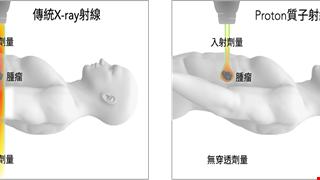 質子治療的優勢