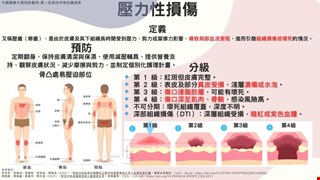 壓力性損傷/RCC1
