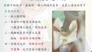 認識氣管造口術/SCU2
