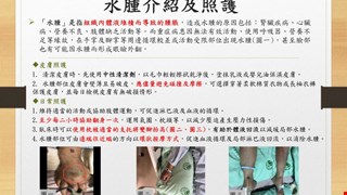 水腫介紹及照護/RCC2