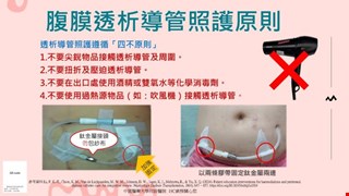 腹膜透析導管照護原則/19C