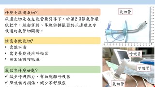 床邊氣切手術介紹/RICU