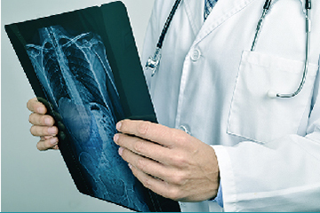 ជំងឺឆ្អឹង