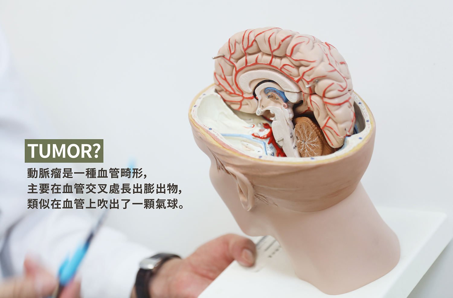 神經外科部 腦血管神經外科 陳春忠醫師