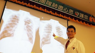 Đánh thức miễn dịch – Đuổi bắt ung thư phổi. Điều trị miễn dịch đang nóng sốt – Cơ hội mới điều trị ung thư phổi
