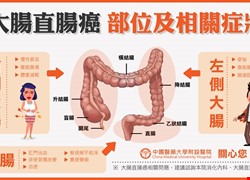 大腸癌部位及相關症狀-大腸直腸癌懶人包3