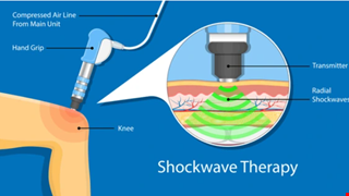 Effects of supplementing extracorporeal shockwave therapy (ESWT) to hyaluronic acid (HA) injection among patients with rotator cuff lesions without complete tear: A prospective double-blinded randomized study