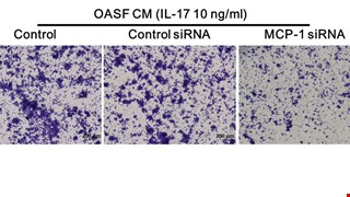 MCP-1 controls IL-17-promoted monocyte migration and M1 polarization in osteoarthritis