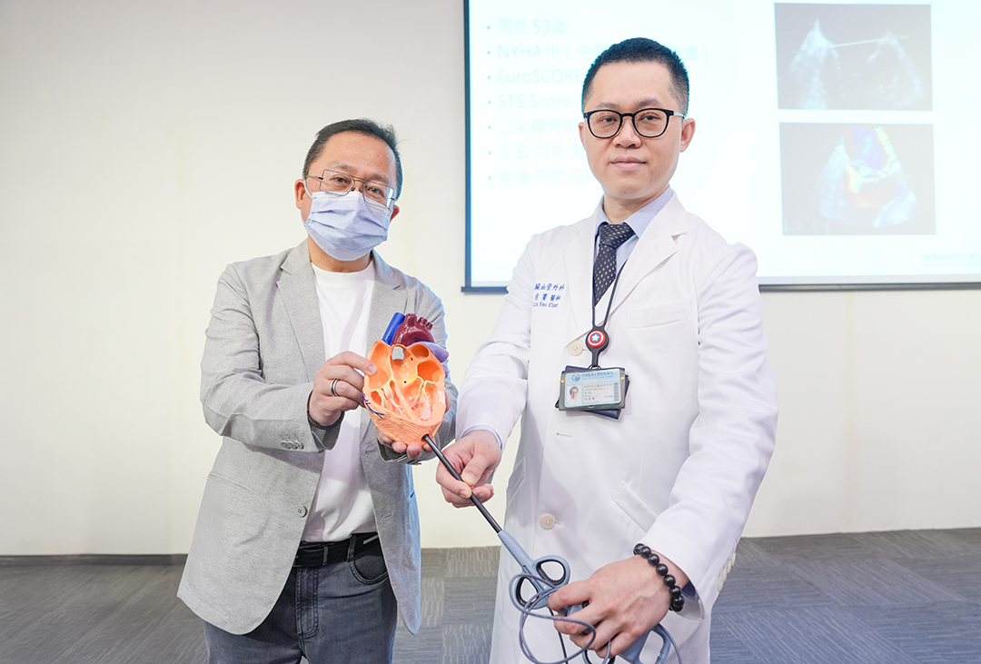 Double Heart Attack” Survivor Undergoes Taiwan’s First NeoChord + PCI Procedure— No Open‑Chest Surgery Needed img